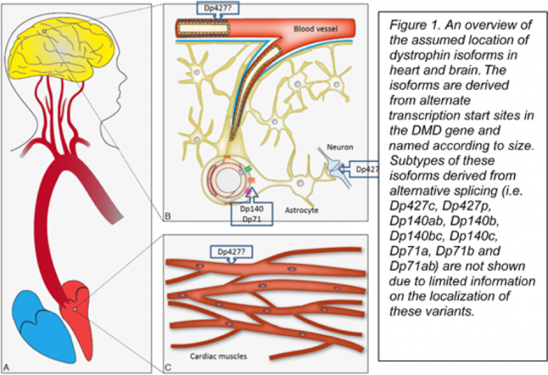 the-background-of-the-reduced-cerebral-blood-flow-in-duchenne-muscular